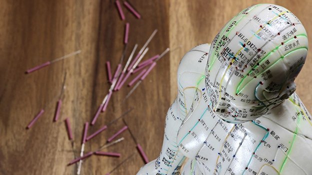 Langzeiteffekte von Akupunktur bei chronischen Schmerzen Metaanalyse untersucht Wirksamkeit der Akupunktur bei Schmerz