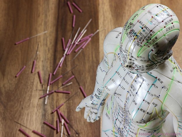 Langzeiteffekte von Akupunktur bei chronischen Schmerzen Metaanalyse untersucht Wirksamkeit der Akupunktur bei Schmerz