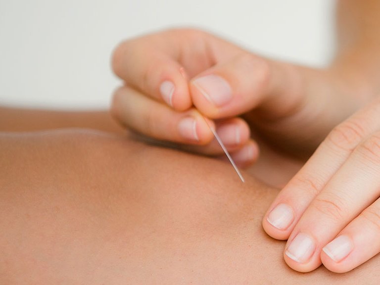 Kniearthrose: Integrative Medizin wirksamer als konventionelle Therapie