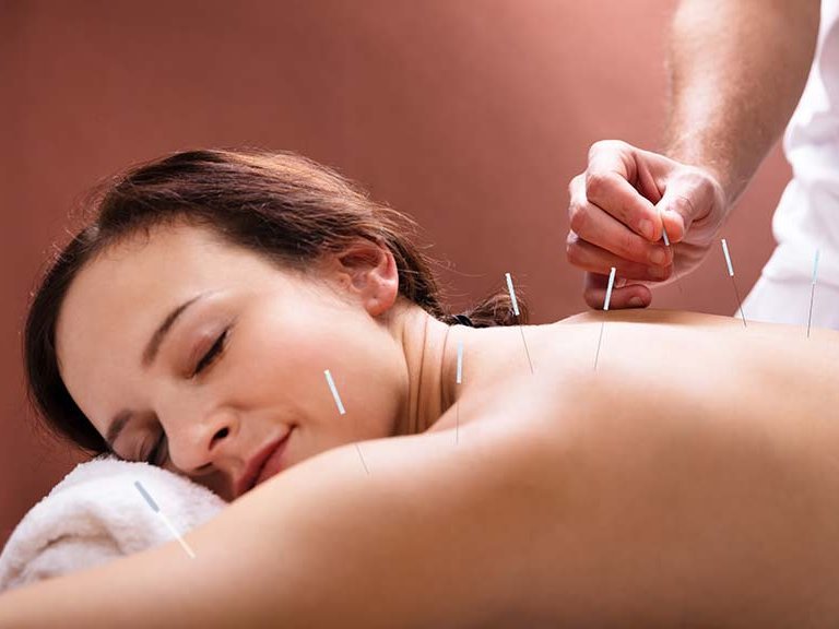 Akupunktur und Wissenschaft Akupunktur und Wissenschaft