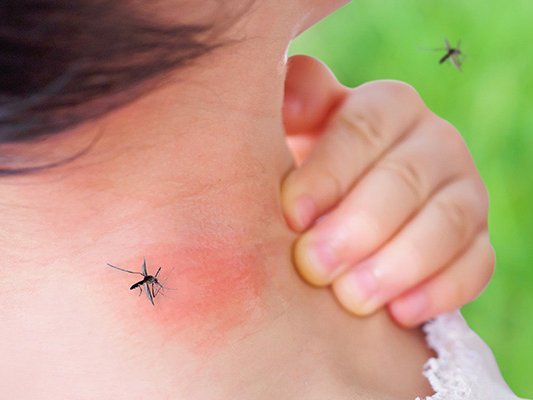 Hitze, Insekten, Sonne – diese zehn Heilpflanzen helfen Hitze, Insekten, Sonne – diese zehn Heilpflanzen helfen