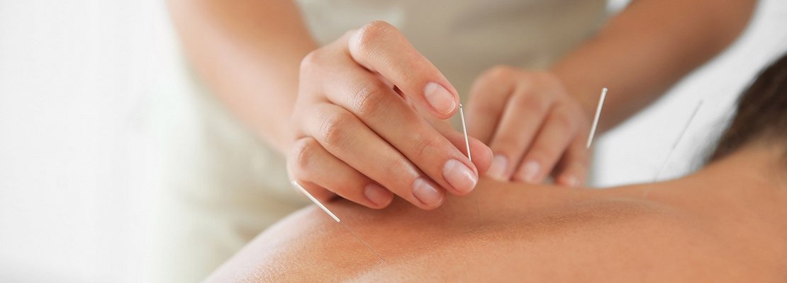 Akupunktur und Massage bei krebsbedingten Schmerzen