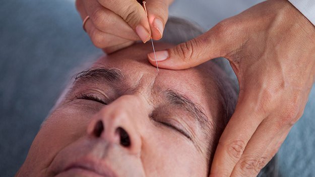 Carstens-Stiftung: Akupunktur unterstützend in der Parkinson-Therapie Carstens-Stiftung: Akupunktur unterstützend in der Parkinson-Therapie