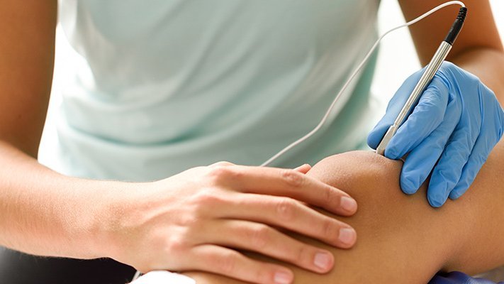 Carstens-Stiftung: Elektroakupunktur kann den Schmerzmittelbedarf bei einer Endosonografie senken Carstens-Stiftung: Elektroakupunktur kann den Schmerzmittelbedarf bei einer Endosonografie senken