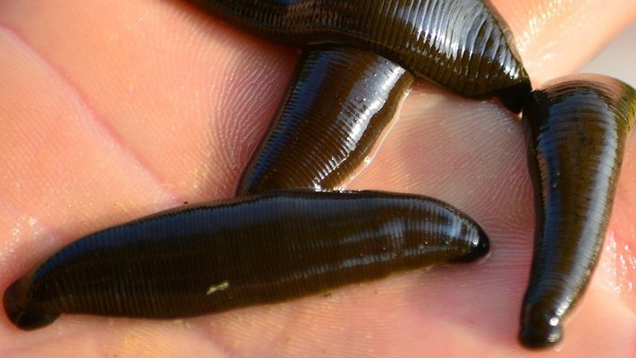 Blutegeltherapie bei Kniegelenksarthrose