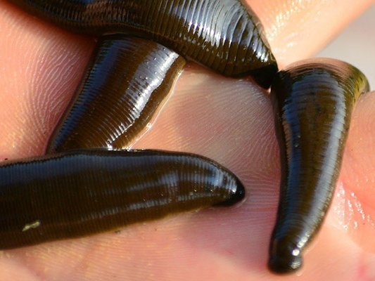 Blutegeltherapie bei Kniegelenksarthrose Blutegeltherapie bei Kniegelenksarthrose