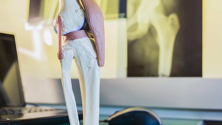 Carstens-Stiftung: Schmerz(mittel)-Reduktion nach Kniegelenksersatz mit nicht-medikamentösen Begleittherapien Carstens-Stiftung: Schmerz(mittel)-Reduktion nach Kniegelenksersatz mit nicht-medikamentösen Begleittherapien