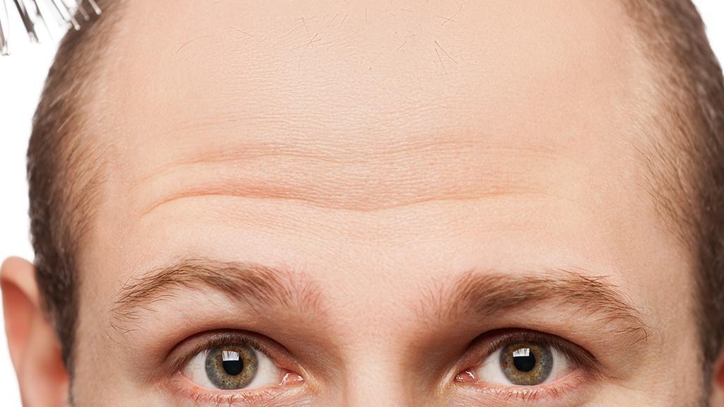 Natürlicher Ansatz gegen den Ansatz