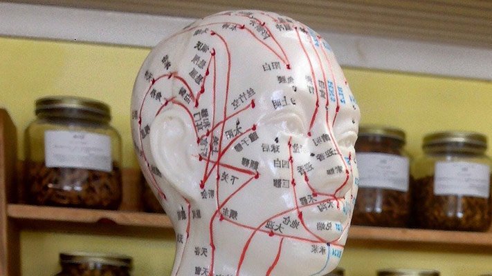 Akupressur und Akupunktur: Eine Übersicht Akupressur und Akupunktur: Eine Übersicht