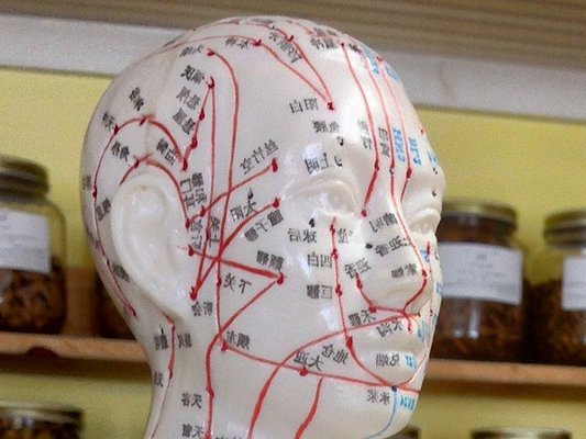 Akupressur und Akupunktur: Eine Übersicht