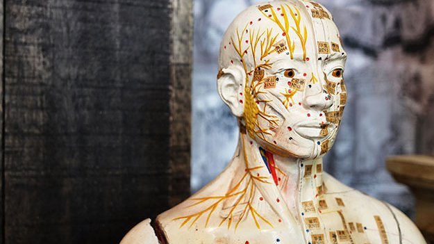 Carstens-Stiftung: Akupunktur mit Elektrostimulation zur nachhaltigen Migräneprophylaxe