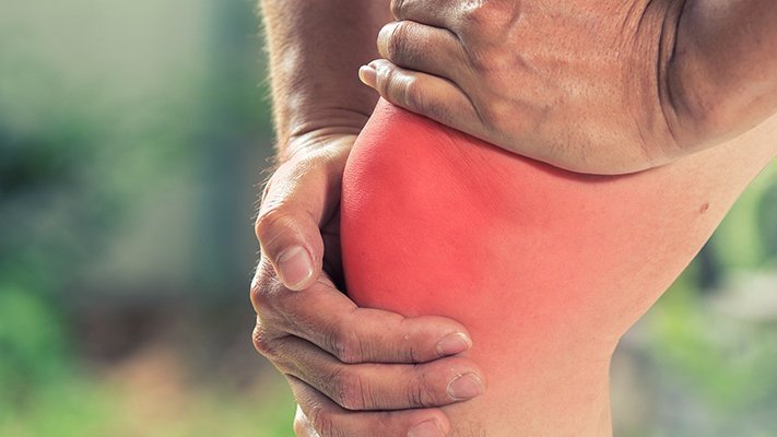 „Cooler“ Kohl: Akute Knieverletzungen heilen schneller mit Kohlwickeln plus Kälte „Cooler“ Kohl: Akute Knieverletzungen heilen schneller mit Kohlwickeln plus Kälte