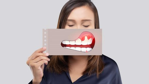 Pulpa dentis statt Wurzelkanalbehandlung?