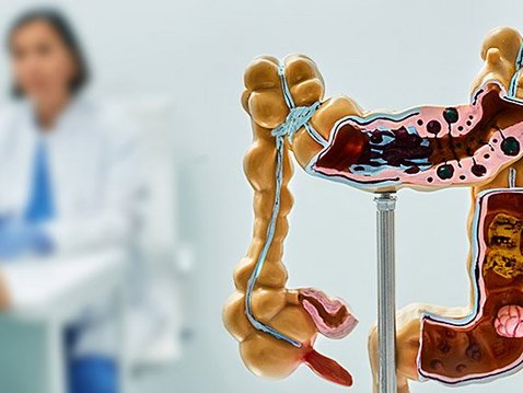 Morbus Crohn – Stressreduktions- und Lebensstilmodifikations-Programm