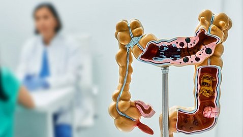 Morbus Crohn – Stressreduktions- und Lebensstilmodifikationsprogramm