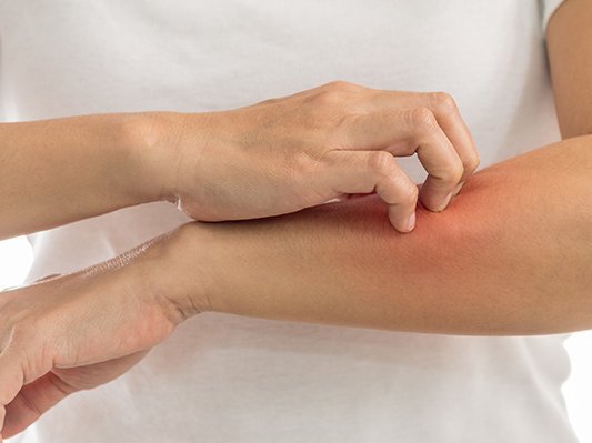 Carstens-Stiftung: Natürliche Behandlung der Schuppenflechte