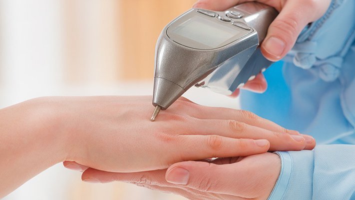 Carstens-Stiftung: Elektroakupunktur – eine Option bei Depressionen in den Wechseljahren