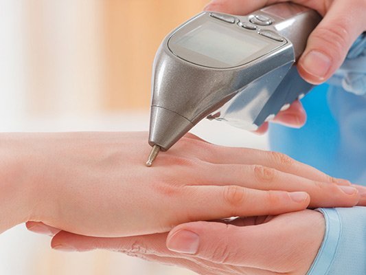 Carstens-Stiftung: Elektroakupunktur – eine Option bei Depressionen in den Wechseljahren Carstens-Stiftung: Elektroakupunktur – eine Option bei Depressionen in den Wechseljahren