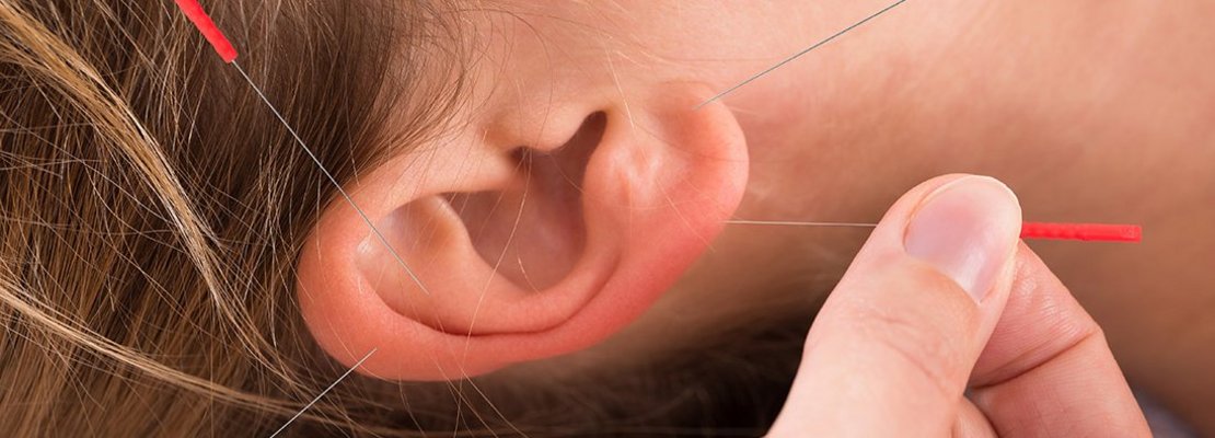 Lindert Akupunktur chronische Schmerzen bei Krebsüberlebenden?