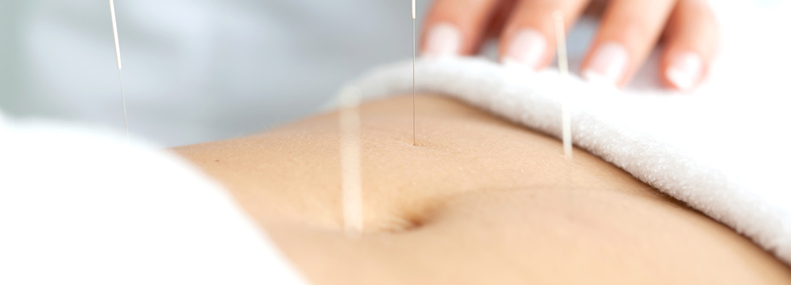 Akupunktur zur Schmerzlinderung nach Operationen