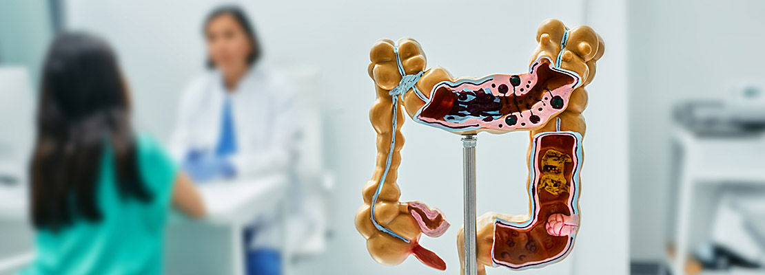 Morbus Crohn – Stressreduktions- und Lebensstilmodifikations-Programm