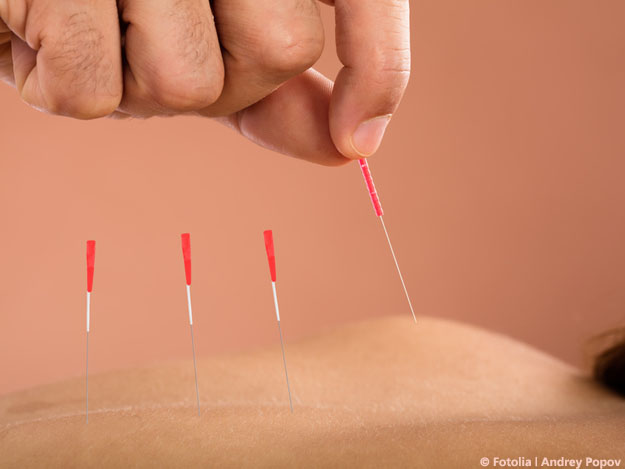 Carstens-Stiftung: Akupunktur und Bewegung sind gut bei einem Hexenschuss. Carstens-Stiftung: Akupunktur und Bewegung sind gut bei einem Hexenschuss.