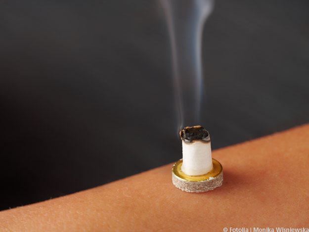 Moxibustion zur Unterstützung der körperlichen Genesung nach Schlaganfall Moxibustion zur Unterstützung der körperlichen Genesung nach Schlaganfall