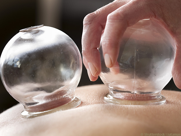 Carstens-Stiftung: Schröpfen