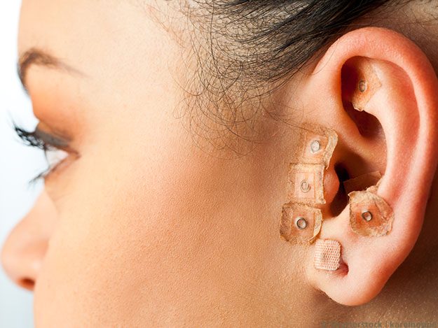 Studienaufruf: Ohrakupunktur in der Behandlung von Schlafstörungen nach Brustkrebs Studienaufruf: Ohrakupunktur in der Behandlung von Schlafstörungen nach Brustkrebs